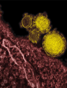 Grainy, pink and yellow spheres of Middle East respiratory syndrome coronavirus.