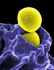 Yellow spheres of methicillin-resistant staphylococcus aureus.