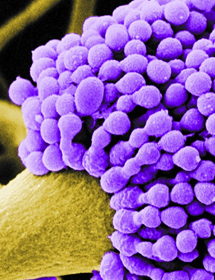 Green stem attached to a cluster of small, round, purple Aspergillus fumigatus .