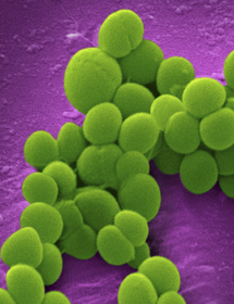 Cluster of green, grape-shaped methicillin-resistant Staphylococcus aureus bacteria.