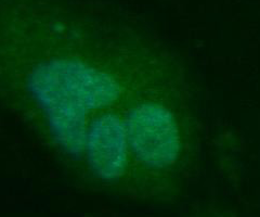 Green human umbilical vein endothelial cells.