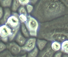 Gray and green corneal cells.