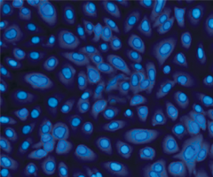 Blue lung epithelial cystic fibrosis cells.