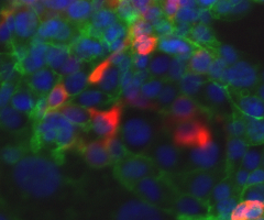 Fluorescent blue, red, and green colon cells.