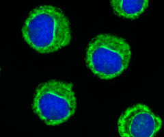 Fluorescent blue and green spheres of leukemic cells.