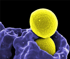 Yellow spheres of methicillin-resistant staphylococcus aureus.