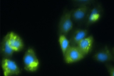 Clusters of blue and green exosomes.