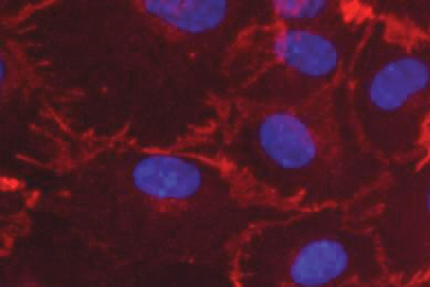 Purple, red and black human umbilical vein endothelial cells.