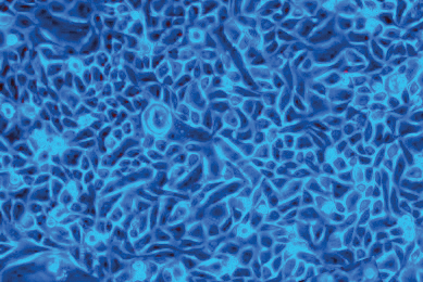 Small, fluorescent blue and white prostate cells.