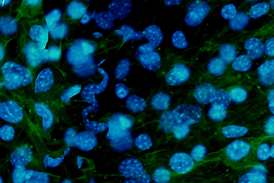 Blue green and black fibroblast.