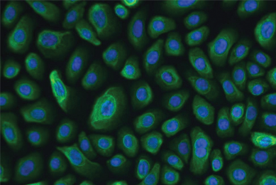 Green and blue NuLi lung epithelial small airway cells.