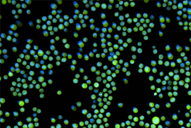 Green K562-GFP with nuclear stain.