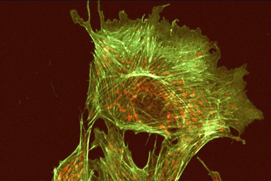 Fluorescent yellow-green and orange, lung endothelial cells.