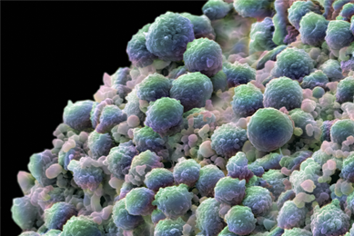 Green prostate cancer cells.