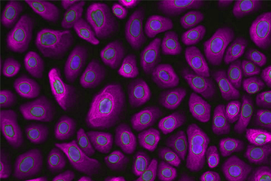 Purple and blue normal bronchial lung epithelial cells.