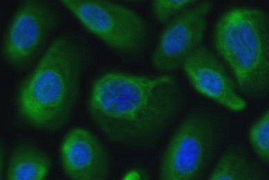 Green and blue normal bronchial lung epithelial cells.