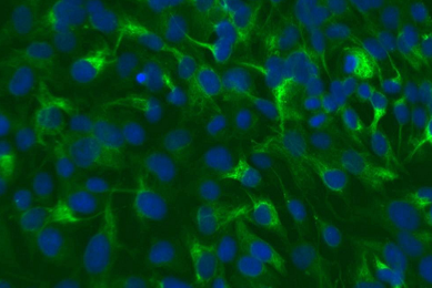 Green and blue kidney epithelial melanocyte cells.