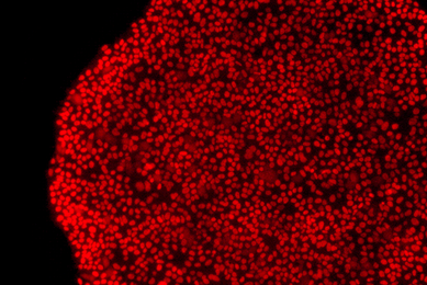 Red IPSC colony nanog cells.