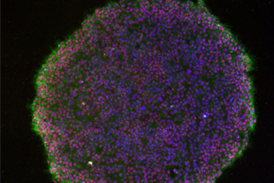 Green and purple induced pluripotent stem dermal fibroblast cells.
