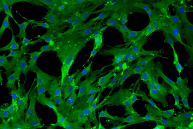 Green and blue mesenchymal IPS stem cells.