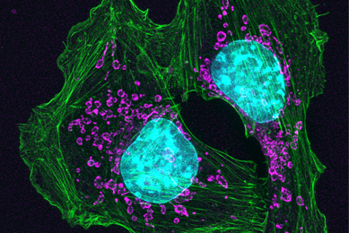 Purple and green top mouse skin cancer cells.