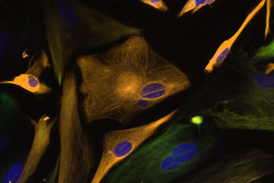 Brown and blue neural progenitor stem cells.