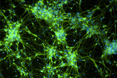 Green and blue dopaminergic Diff MAP2 DAPI cells.