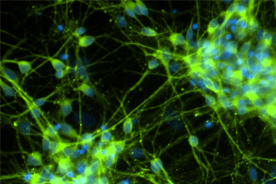 Green and blue dopaminergic neural progenitor cells