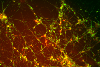 Green and orange dopaminergic neural progenitor cells