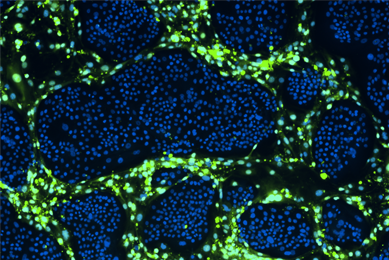 Green and blue conditionally reprogrammed organoid cells.