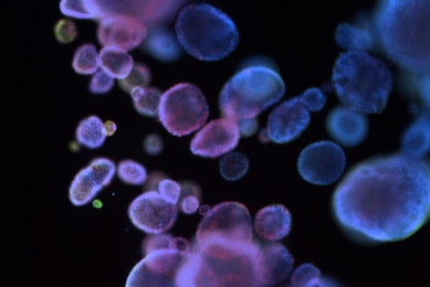 Blue and purple ICC organoid cells.