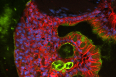 Green, pink and blue organoid cells.