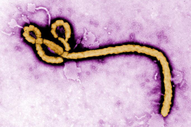 Coiled, yellow, worm-like ebola virus.