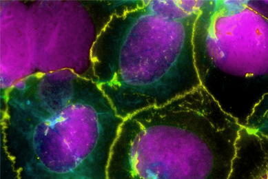 Purple yellow and green Caco2 intestinal epithelial cells.