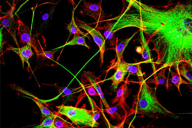 Green and red monolayer tubulin cells.