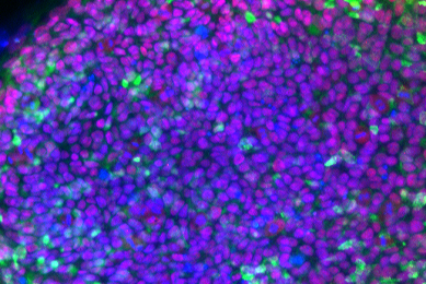 Small, round, fluorescent purple, green, and blue cells.