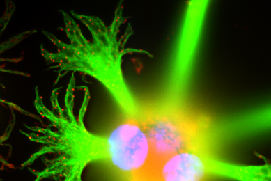 Star fish-shaped, fluorescent lime green, rat brain glioma cell.