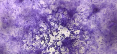 Microscopic image showing a cluster of purple-stained VR-734 cells with a scale bar indicating 500 micrometers.
