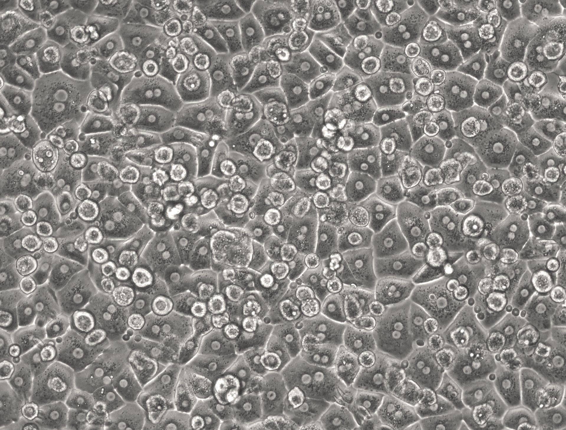 Hepatocytes shown on day 2