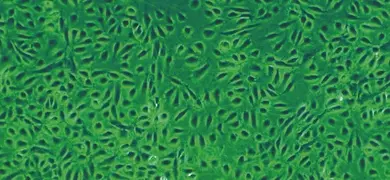 Fluorescent green and black primary microvascular endothelial cells.