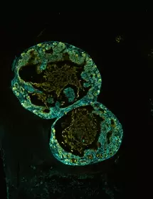 Green ECAD organoid cells.