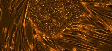 Long, fluorescent orange and brown embryonic stem cells.