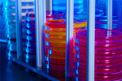 Several stacks of petri dishes containing various colored media, in rack.