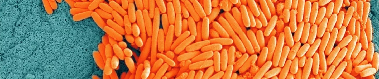 Baby carrot-like pile of Clostridium difficile bacteria.