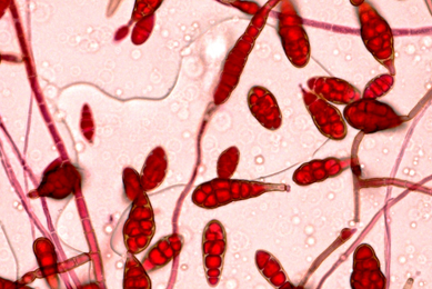 Red alternaria cells.