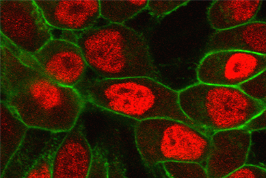 Red and green Lncap clone prostate cells.
