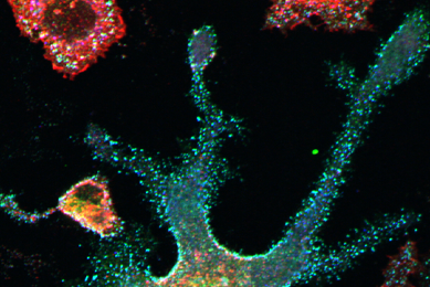 Immune System Disorders Atcc