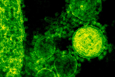 Green MERS-CoV cells.