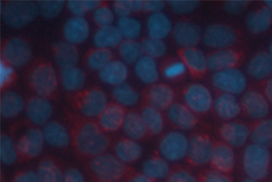 Blue and red donor upcyte hepatocytes.