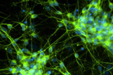 Fluorescent green and blue neurons.